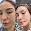 Chị Hằng, 38 tuổi