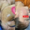  Cô Hạnh, 43 tuổi